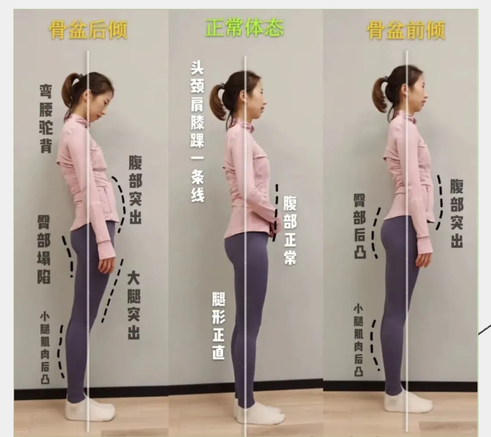 為什么越來越多的女性，產(chǎn)后都開始做骨盆修復(fù)？